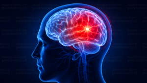 La inteligencia artificial ya puede analizar imágenes cerebrales y detectar señales de un ACV en minutos, ayudando a que los equipos médicos actúen más rápido. No reemplaza al neurólogo, pero puede acelerar el diagnóstico y reducir tiempos críticos. En un accidente cerebrovascular, cada minuto cuenta. La tecnología avanza, pero la decisión final sigue estando en manos de profesionales. Imagen creada por posicionarte.cl